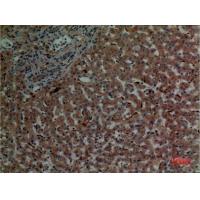 Cathepsin L Polyclonal Antibody