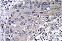 Cathepsin D Polyclonal Antibody