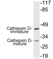 Cathepsin D Polyclonal Antibody