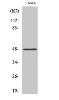Cathepsin E Polyclonal Antibody