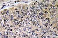 Cathepsin E Polyclonal Antibody