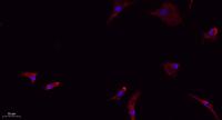 Caveolin-1 Polyclonal Antibody