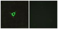 CB1 Polyclonal Antibody