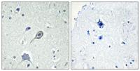 CB1 Polyclonal Antibody