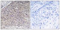 MAST4 Polyclonal Antibody