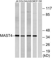 MAST4 Polyclonal Antibody