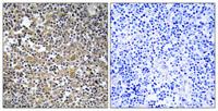 MAST205 Polyclonal Antibody