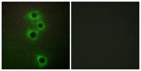 MARK4 Polyclonal Antibody