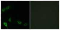 MARK2 Polyclonal Antibody