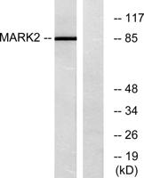 MARK2 Polyclonal Antibody