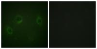 MARK1/2/3/4 Polyclonal Antibody