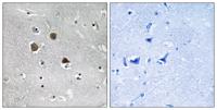 MARK1/2/3/4 Polyclonal Antibody