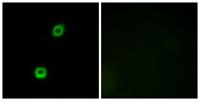 MARCKS Polyclonal Antibody
