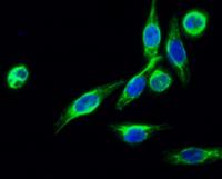 MARCH5 Polyclonal Antibody