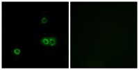 MARCH5 Polyclonal Antibody