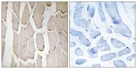 MARCH3 Polyclonal Antibody