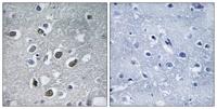 MARCH4 Polyclonal Antibody