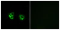 MARCH2 Polyclonal Antibody