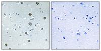MARCH2 Polyclonal Antibody