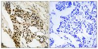 MAPKAPK-2 Polyclonal Antibody