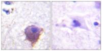 MAP-4 Polyclonal Antibody