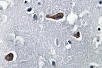 MAP-2 Polyclonal Antibody