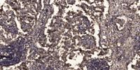 MAP1B Polyclonal Antibody