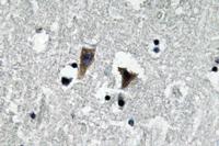 MAO-A Polyclonal Antibody