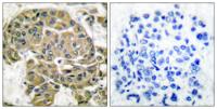 Mammaglobin B Polyclonal Antibody