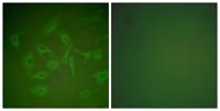 Mammaglobin A Polyclonal Antibody