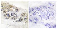 Mammaglobin A Polyclonal Antibody