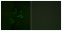 Cbl Polyclonal Antibody