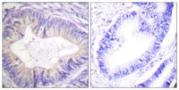 Cbl Polyclonal Antibody