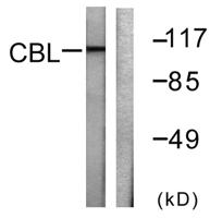 Cbl Polyclonal Antibody
