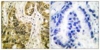 CBP 35 Polyclonal Antibody