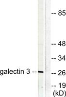CBP 35 Polyclonal Antibody