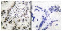 CREB-BP Polyclonal Antibody