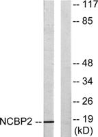 CBP20 Polyclonal Antibody