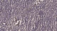 CBX2 Polyclonal Antibody
