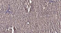 CBX6 Polyclonal Antibody