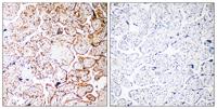 CCDC102B Polyclonal Antibody