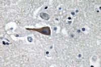 CCK Polyclonal Antibody