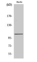 CCP2 Polyclonal Antibody
