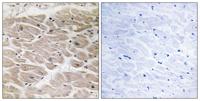 CCP2 Polyclonal Antibody