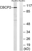 CCP2 Polyclonal Antibody