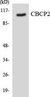 CCP2 Polyclonal Antibody