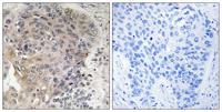CCP3 Polyclonal Antibody