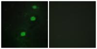 CCRK Polyclonal Antibody
