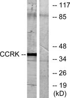 CCRK Polyclonal Antibody