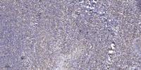 CCRK Polyclonal Antibody